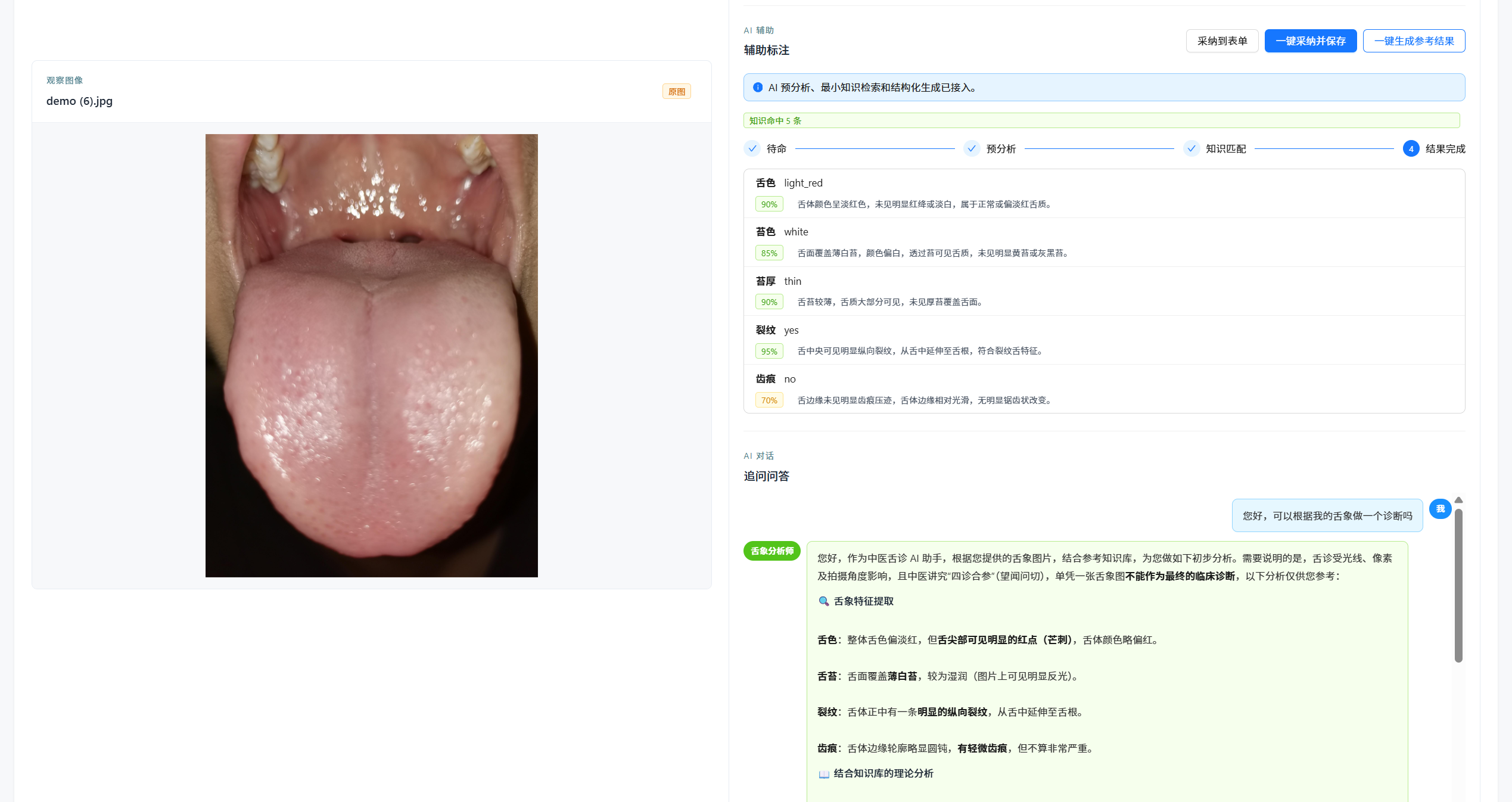 人机混合标注 · 沉淀高质量舌象识别数据集